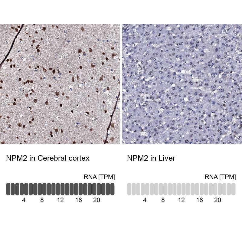 Immunohistochemistry-Paraffin Nucleoplasmin-2 Antibody - BSA Free