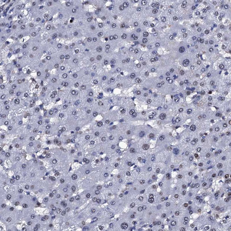 Staining of human liver shows no positivity in hepatocytes as expected.