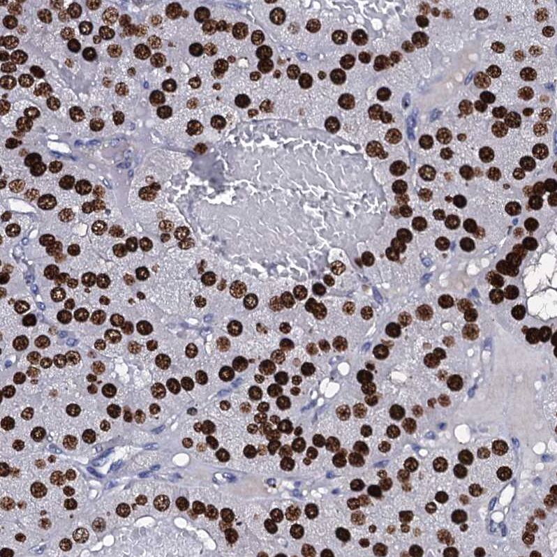 Staining of human parathyroid gland shows strong nuclear positivity in glandular cells.
