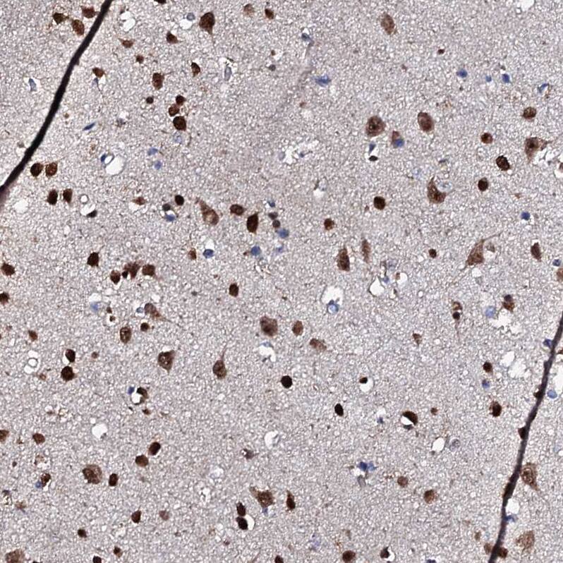 Staining of human cerebral cortex shows strong nuclear and cytoplasmic positivity in neurons.