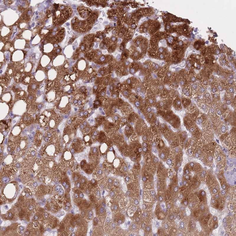 Staining of human liver shows strong cytoplasmic positivity in hepatocytes .