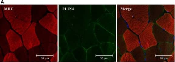 Perilipins (PLIN)4 is mostly expressed in slow muscle fibers. (A) Representative images (400X) from confocal fluorescence microscopy of sections of paraffin-embedded biopsies from m. vastus lateralis (n = 10), stained with antibodies against myosin heavy chain fast (red, mouse anti-myosin heavy chain; skeletal, fast) and PLIN4 (green, guinea pig anti-PLIN4). Fast muscle fibers are stained in bright red color, whereas slow fibers appear as dark. (B) M. soleus and m. gastrocnemius were dissected from male C57BL/6N mice (n = 5) and Plin4 mRNA expression was determined by quantitative RT-PCR. Plin4 mRNA was normalized to Tbp mRNA. Results are presented as means +/- SEM, *P < 0.05 (two-tailed Student’s t-test). Image collected and cropped by CiteAb from the following open publication (//pubmed.ncbi.nlm.nih.gov/26265748), licensed under a CC-BY license. Not internally tested by Novus Biologicals.