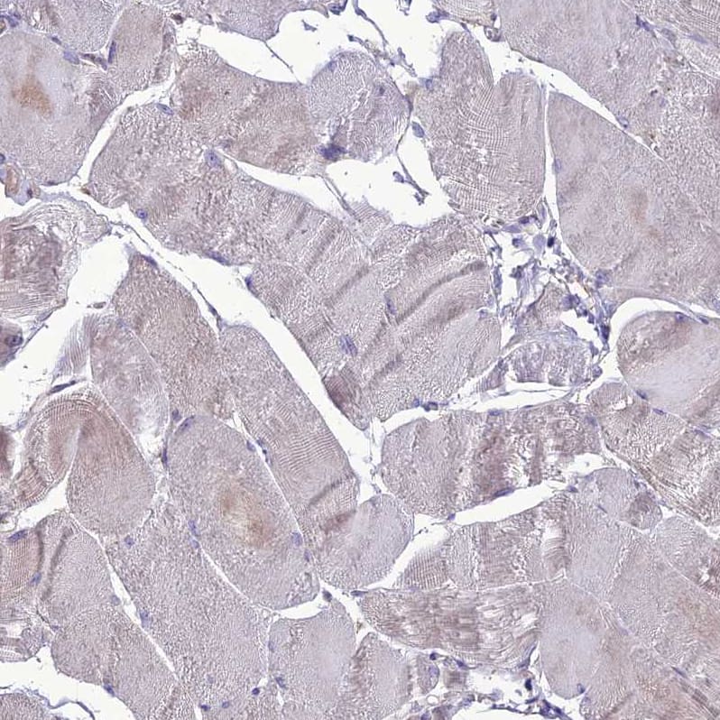 Immunohistochemistry-Paraffin PPIL3 Antibody - BSA Free