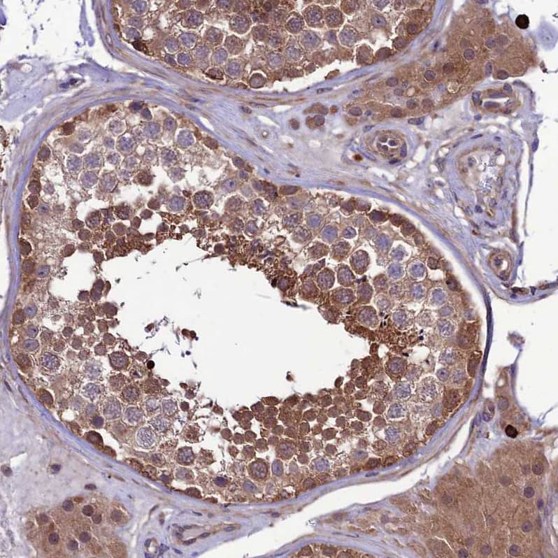 Staining of human testis shows moderate cytoplasmic positivity in cells in seminiferous ducts.