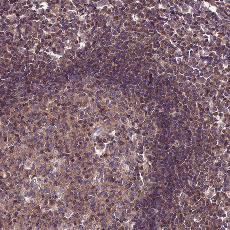 Staining of human lymph node shows moderate cytoplasmic positivity in germinal and non-germinal center cells.