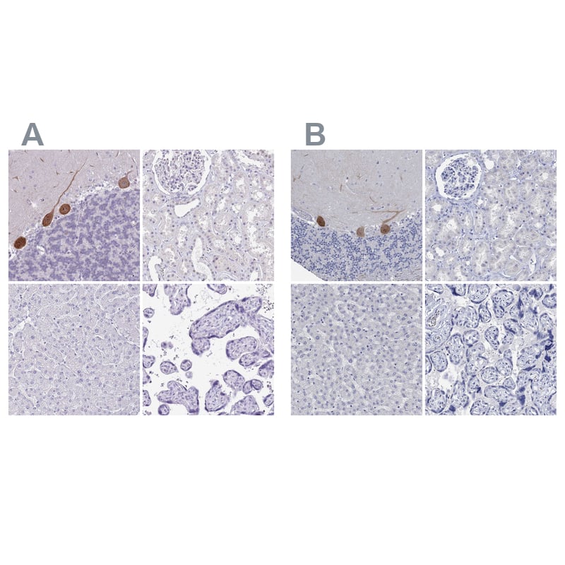 <b>Independent Antibodies Validation. </b>Staining of human cerebellum, kidney, liver and placenta using NBP2-13800 (A) shows similar protein distribution across tissues to independent antibody NBP2-68949 (B).