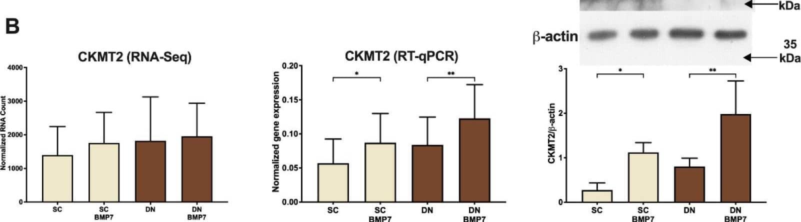 Western Blot CKMT2 Antibody - BSA Free