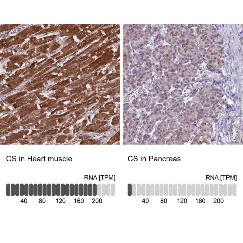 <b>Orthogonal Strategies Validation. </b>Analysis in human heart muscle and pancreas tissues.