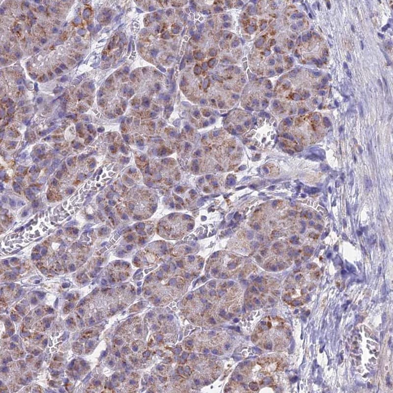 Staining of human pancreas shows low expression as expected.