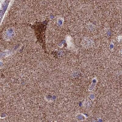 Staining of human cerebral cortex.
