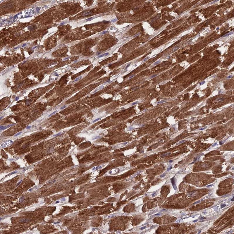 Staining of human heart muscle shows high expression.