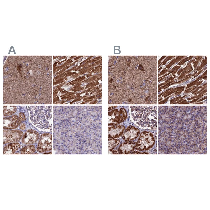 <b>Orthogonal Strategies Validation. </b>Staining of human cerebral cortex, heart muscle, kidney and pancreas HPA038460 (A) shows similar protein distribution across tissues to independent antibody HPA038461 (B).