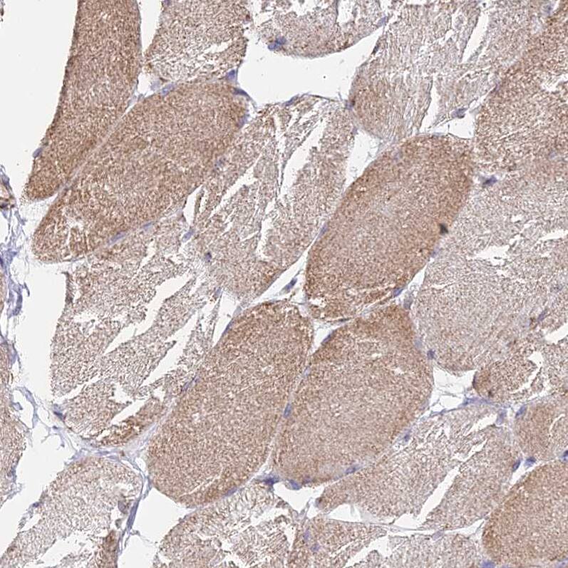 Staining of human skeletal muscle shows weak to moderate cytoplasmic positivity in myocytes.