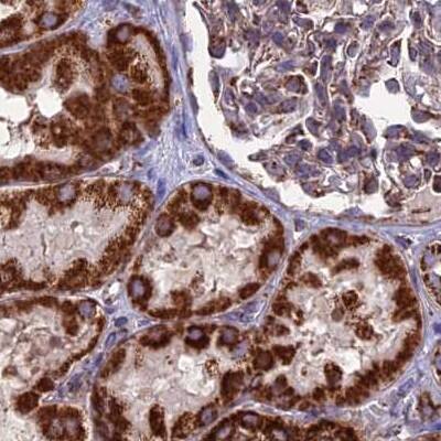 Staining of human kidney.