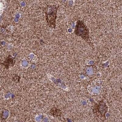 Staining of human cerebral cortex.