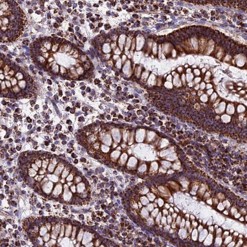 Staining of human colon shows strong cytoplasmic positivity in glandular cells.