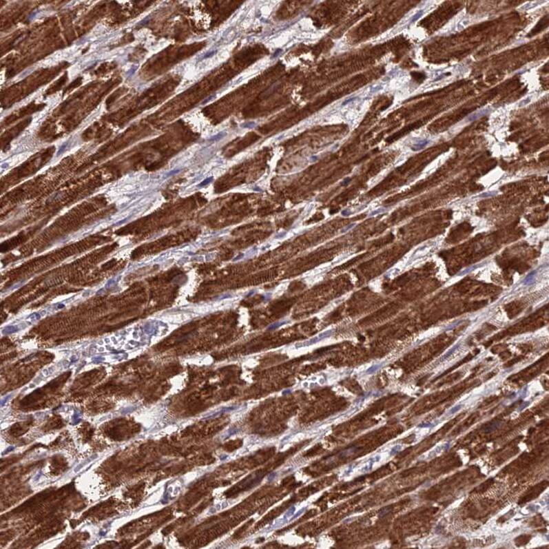 Staining of human heart muscle shows moderate to strong cytoplasmic positivity in cardiomyocytes.