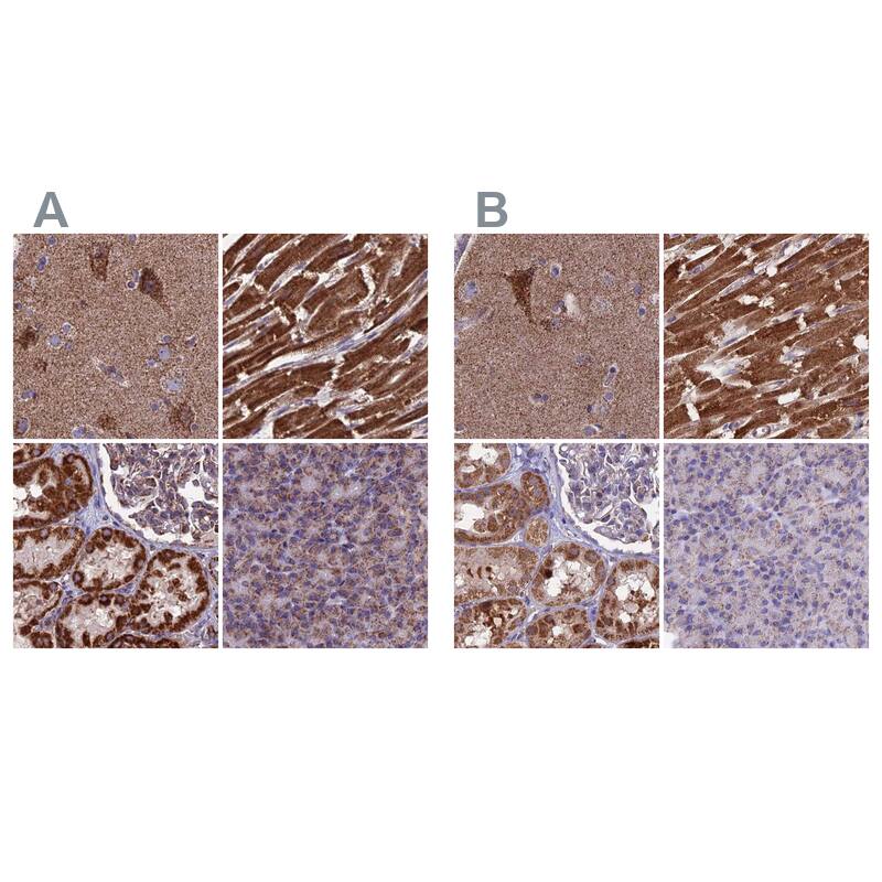 Staining of human cerebral cortex, heart muscle, kidney and pancreas HPA038461 (A) shows similar protein distribution across tissues to independent antibody HPA038460 (B).