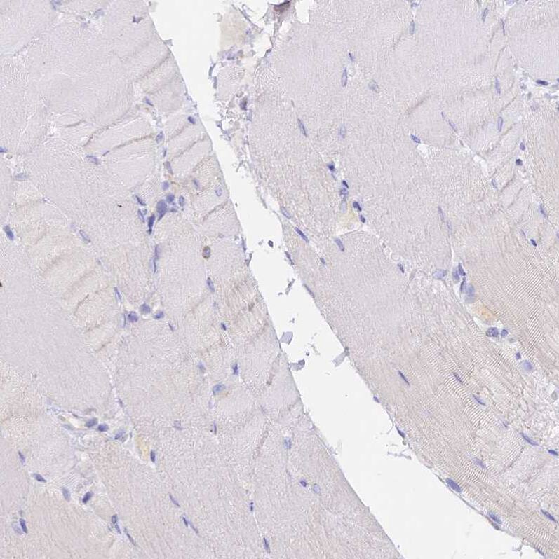 Staining of human skeletal muscle shows no positivity in myocytes as expected.