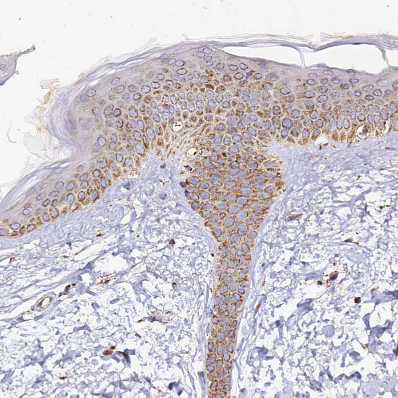 Staining of human skin shows moderate granular cytoplasmic positivity in squamous epithelial cells.