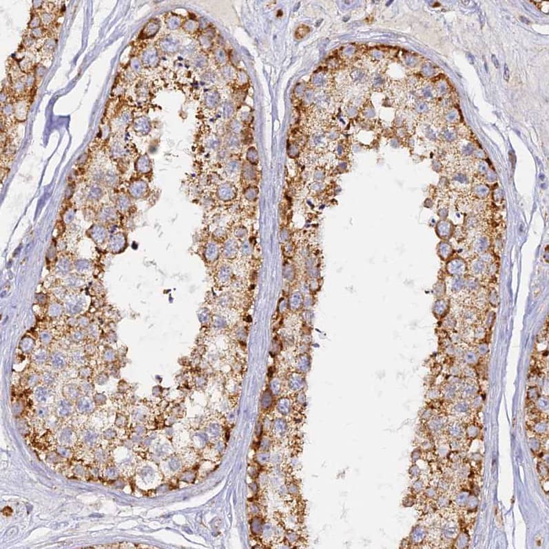 Staining of human testis shows strong granular cytoplasmic positivity in cells in seminiferous ducts.