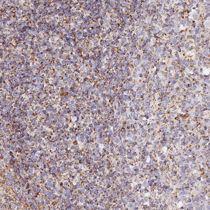 Staining of human tonsil shows strong granular cytoplasmic positivity in non-germinal center cells.