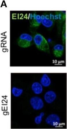 Loss of EI24 expression using CRISPR-Cas9 in MIA PaCa-2 cells decreased cell proliferation. MIA PaCa-2 cells were transfected with CRISPR-Cas9 control (gRNA) and EI24 gRNA (gEI24) using a lentiviral system. (A) After 48 h of incubation, EI24 protein expression was observed by immunofluorescence staining using an anti-EI24 antibody. (B) After 48 h of incubation, the EI24 protein level was observed by western blotting using an anti-EI24 antibody. Conversion of LC3-I to LC3-II and p62 accumulation were analyzed by western blotting using anti-LC3 and anti-p62 antibodies, respectively. Graphs represent the mean +/- SEM of EI24, LC3-II, and p62 densitometry value to that of  beta -actin (with gRNA values set to 1) from three independent experiments. Comparison were made using Student's t-test, *P < 0.05; **P < 0.01; ***P < 0.001. (C) After 24 h of incubation, cells were seeded into a 96-well plate (1,000 cells/well). Images acquired by the IncuCyte instrument at the indicated times were analyzed using the ZOOM 2016 program. Confluency was measured in triplicate wells for each sample. Values represent the means +/- SEM (Student's t-test, *P < 0.05; **P < 0.01; ***P < 0.001). (D) Control and EI24 gRNA-transfected cells (5 × 106) were injected into both flanks of Balb/c nude mice. Tumor volume was measured on the indicated days. The y-axes of these graphs represent the fold change in tumor size relative to the initial tumor size. Values represent means +/- SEM. (Student's t-test, n.s., not significant, control gRNA mice, n = 5; EI24 gRNA mice, n = 4). Image collected and cropped by CiteAb from the following open publication (//pubmed.ncbi.nlm.nih.gov/31396480), licensed under a CC-BY license. Not internally tested by Novus Biologicals.