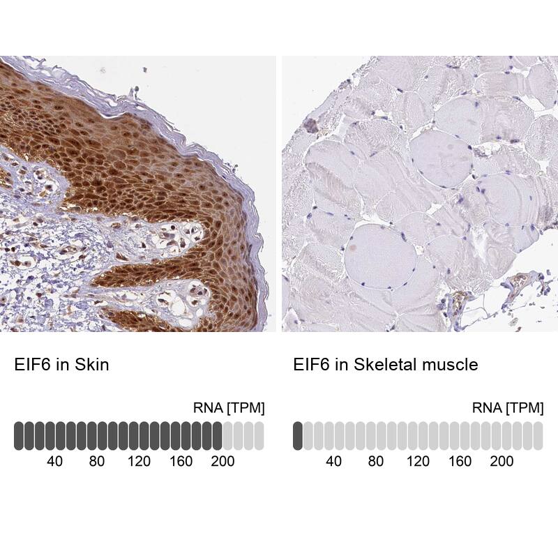 Analysis in human skin and skeletal muscle tissues. Corresponding RNA-seq data are presented for the same tissues.