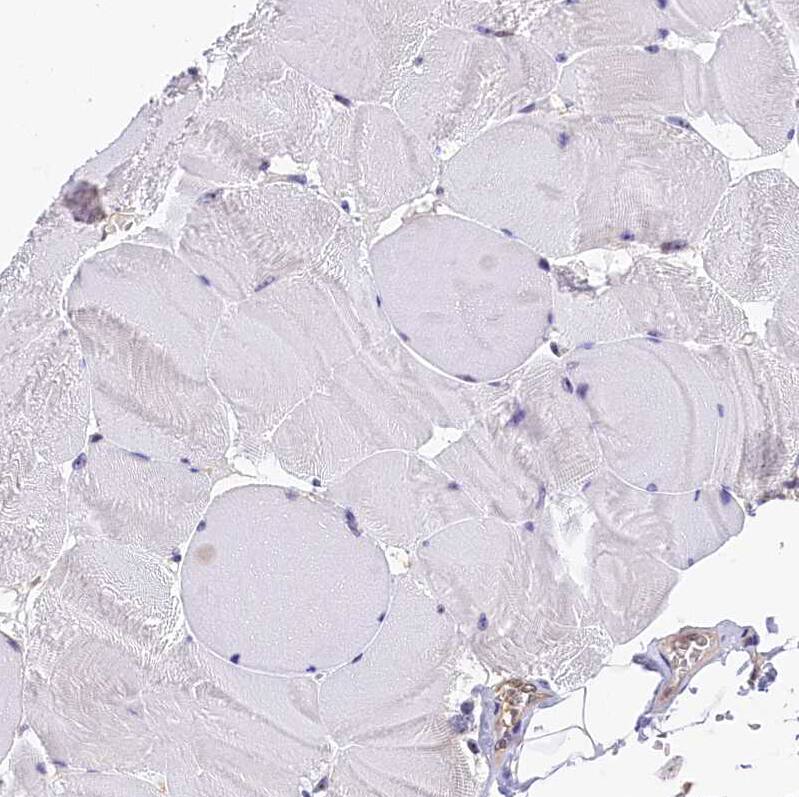 Staining of human Skeletal muscle shows very weak cytoplasmic positivity in myocytes.