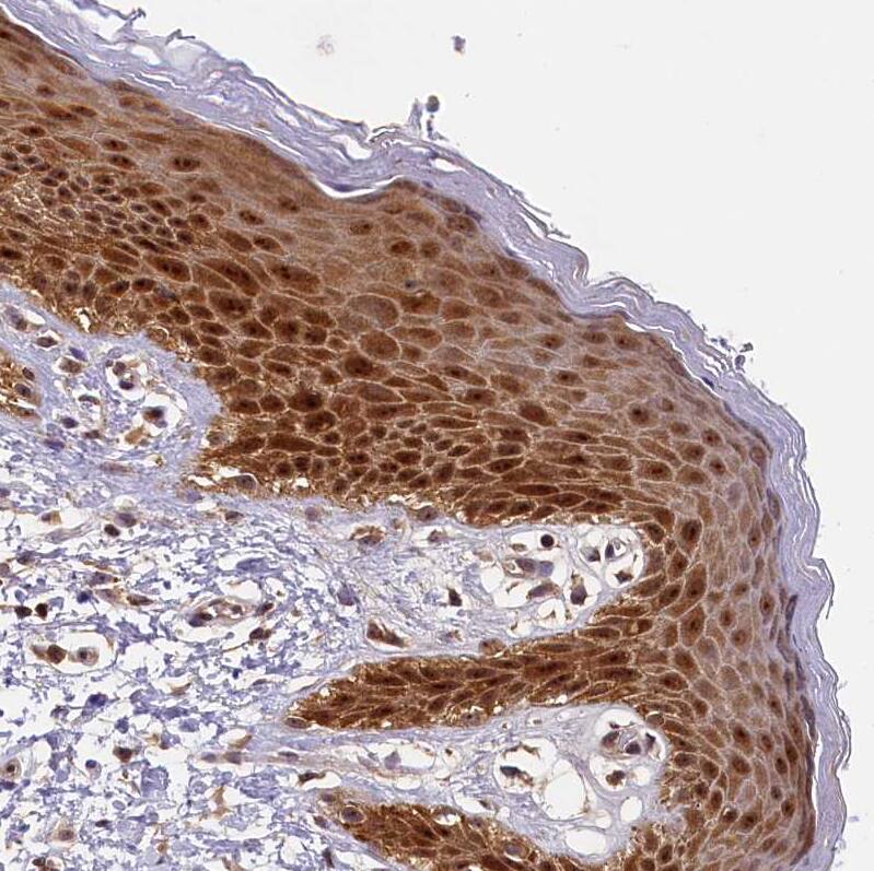 Staining of human Skin shows strong nuclear and cytoplasmic positivity in squamous epithelial cells.