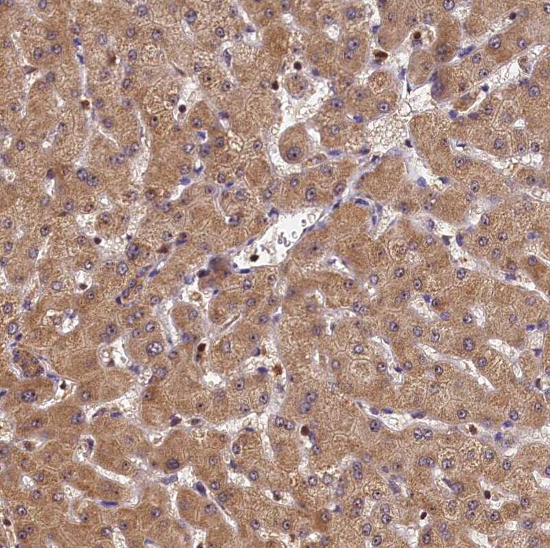 Staining of human Liver shows strong cytoplasmic positivity in hepatocytes.