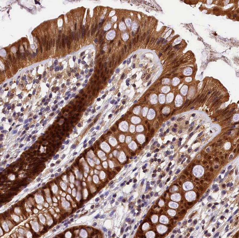 Staining of human Colon shows strong nuclear and cytoplasmic positivity in glandular cells.