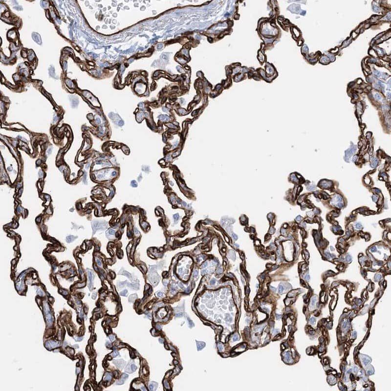Immunohistochemistry-Paraffin EPS8L3 Antibody - BSA Free