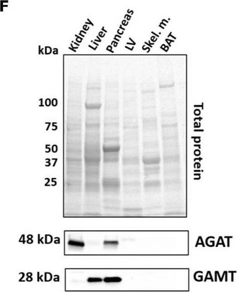 Expression levels of creatine biosynthetic enzymes in a panel of C57BL/6J mouse tissues. (A,D) mRNA and protein levels respectively, for AGAT. (B,E) mRNA and protein levels, respectively for GAMT. (C) mRNA levels for Slc6A8 (Creatine transporter). (F) Representative images from protein electrophoresis showing total protein panel used for normalization purposes, in addition to protein signal detected for AGAT (48 kDa) and GAMT (28 kDa). Image collected and cropped by CiteAb from the following open publication (//pubmed.ncbi.nlm.nih.gov/36017222), licensed under a CC-BY license. Not internally tested by Novus Biologicals.
