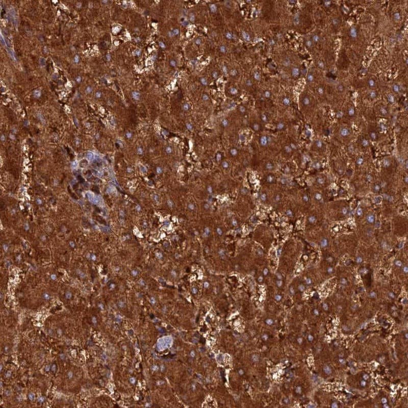 Staining of human liver shows strong cytoplasmic positivity in hepatocytes.