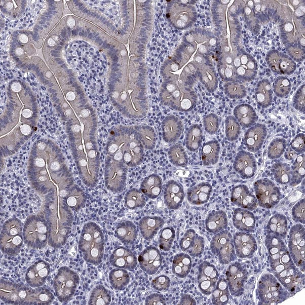 Staining of human duodenum shows strong cytoplasmic positivity in enteroendocrine cells.