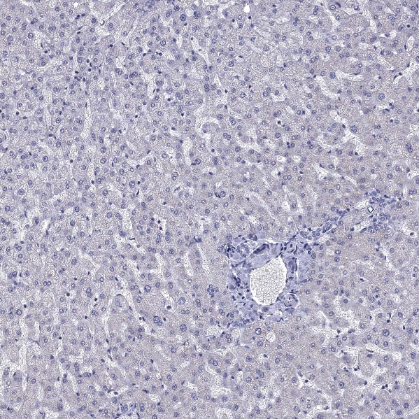 Staining of human liver shows no positivity in hepatocytes as expected.
