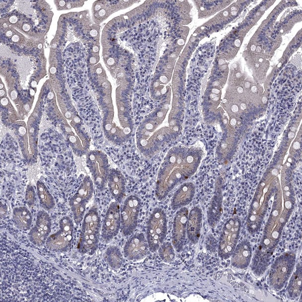 Staining of human small intestine shows strong cytoplasmic positivity in enteroendocrine cells.
