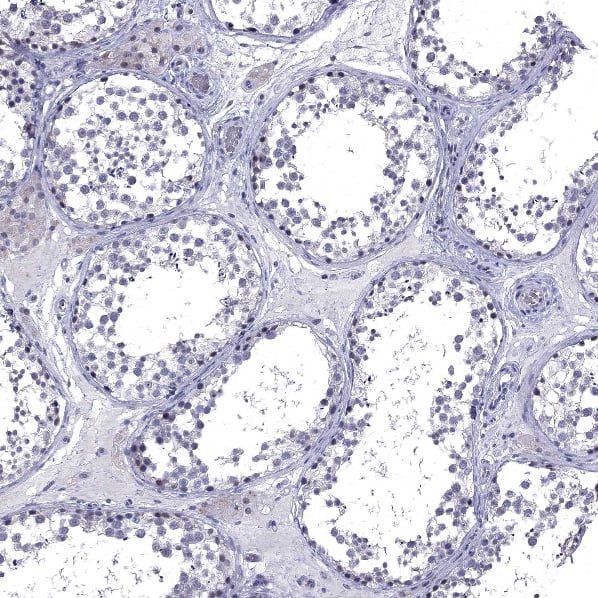 Staining of human testis shows no positivity in cells in seminiferous ducts as expected.