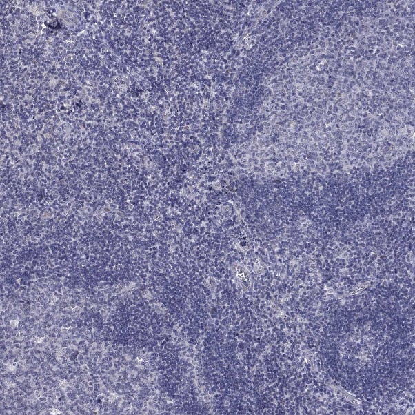 Staining of human tonsil shows no positivity in germinal and non-germinal center cells as expected.