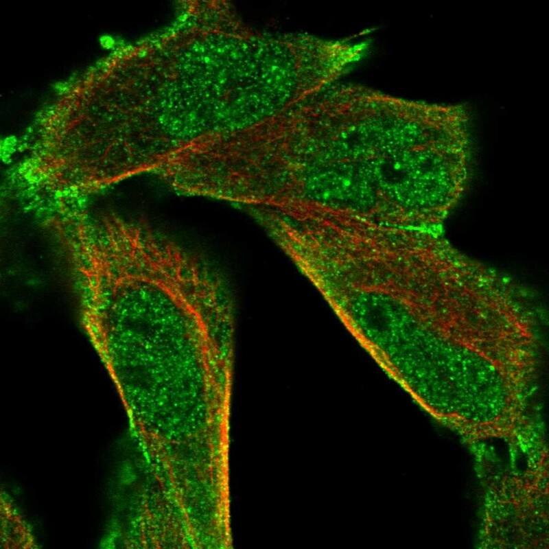 Immunocytochemistry/ Immunofluorescence HUNK Antibody - BSA Free