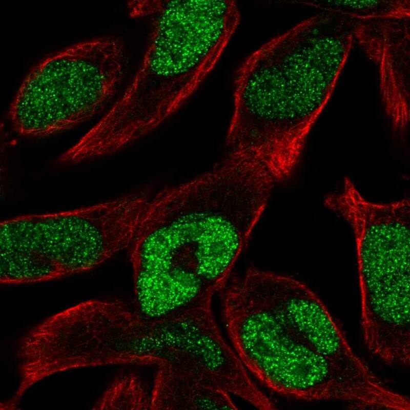 Staining of human cell line RH-30 shows localization to nucleus.
