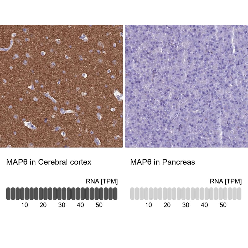 Immunohistochemistry-Paraffin MAP6 Antibody - BSA Free