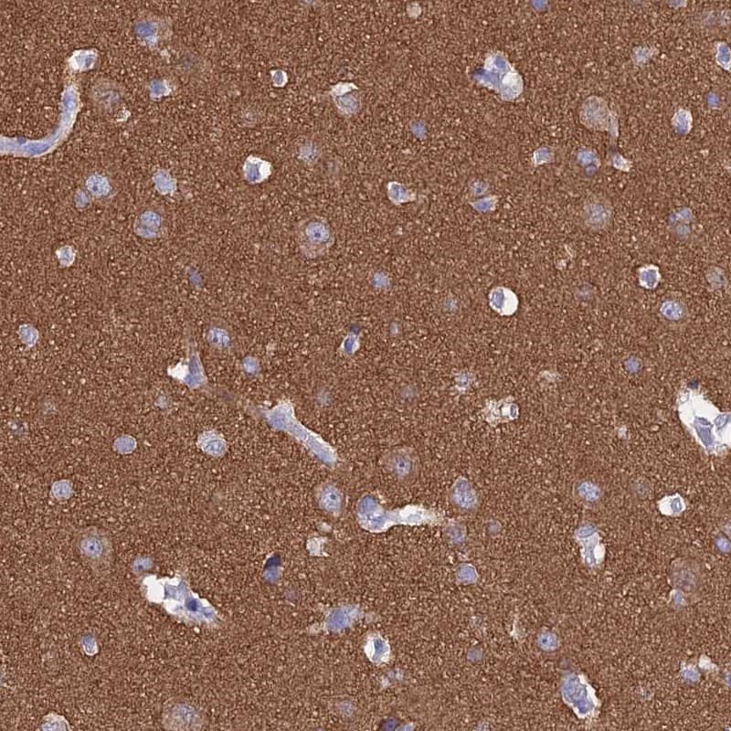 Immunohistochemistry-Paraffin MAP6 Antibody - BSA Free