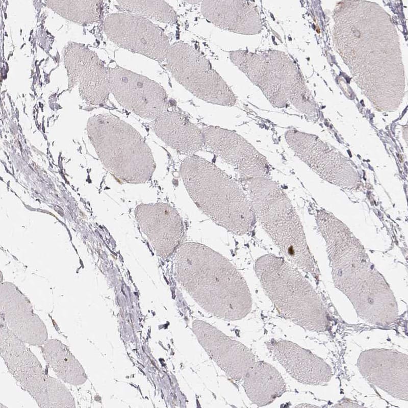 Staining of human skeletal muscle shows no positivity in myocytes as expected.