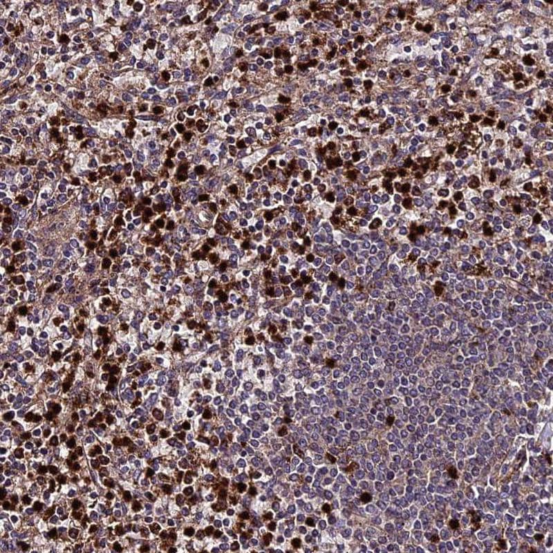 Staining of human spleen shows strong cytoplasmic positivity in a subset of cells in red pulp.