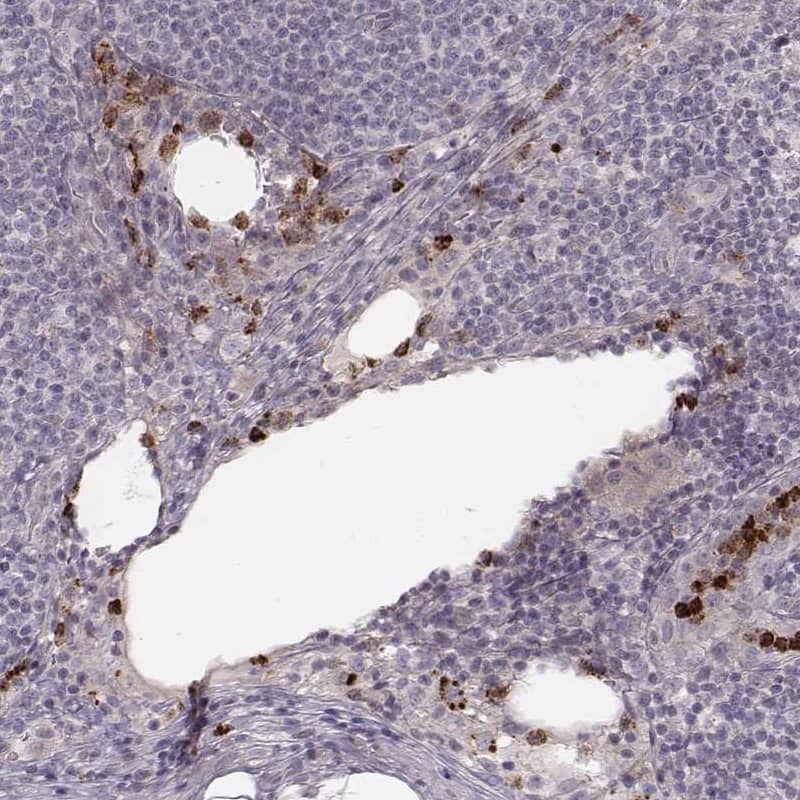 Staining of human lymph node shows moderate positivity in lymphoid cells.