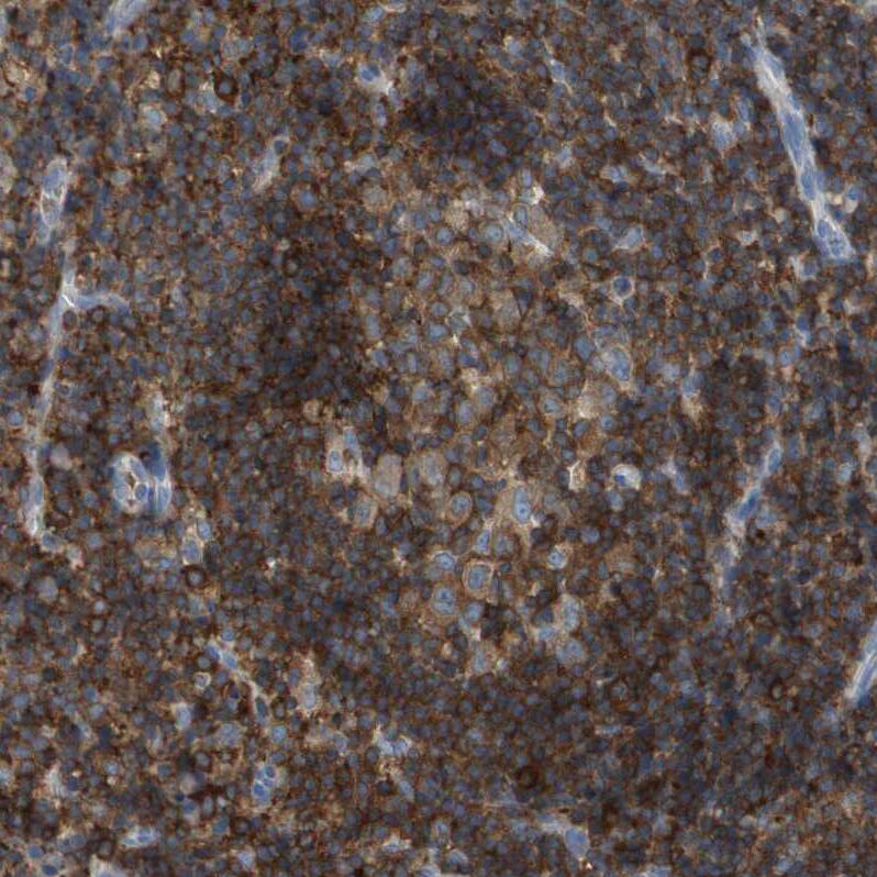 Staining of human lymph node shows very strong cytoplasmic positivity in germinal center cells.