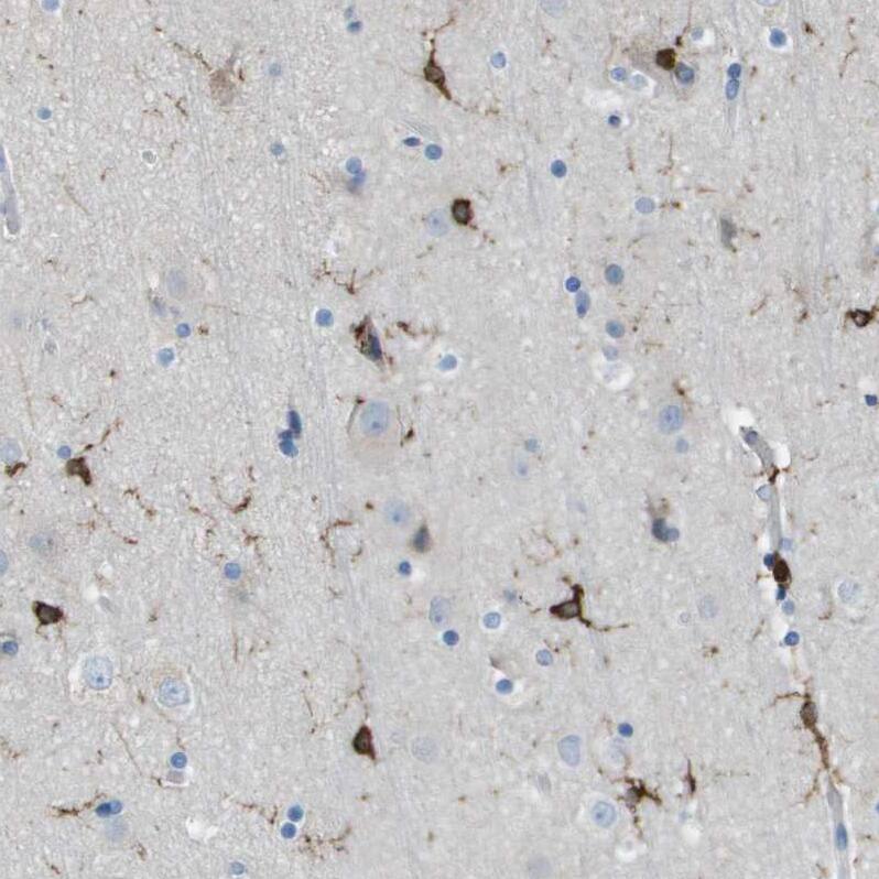 Staining of human cerebral cortex shows strong cytoplasmic positivity in glial cells.