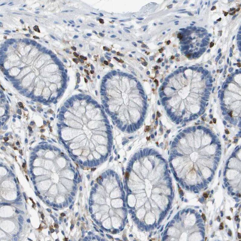 Staining of human colon shows strong cytoplasmic positivity in lymphoid cells.